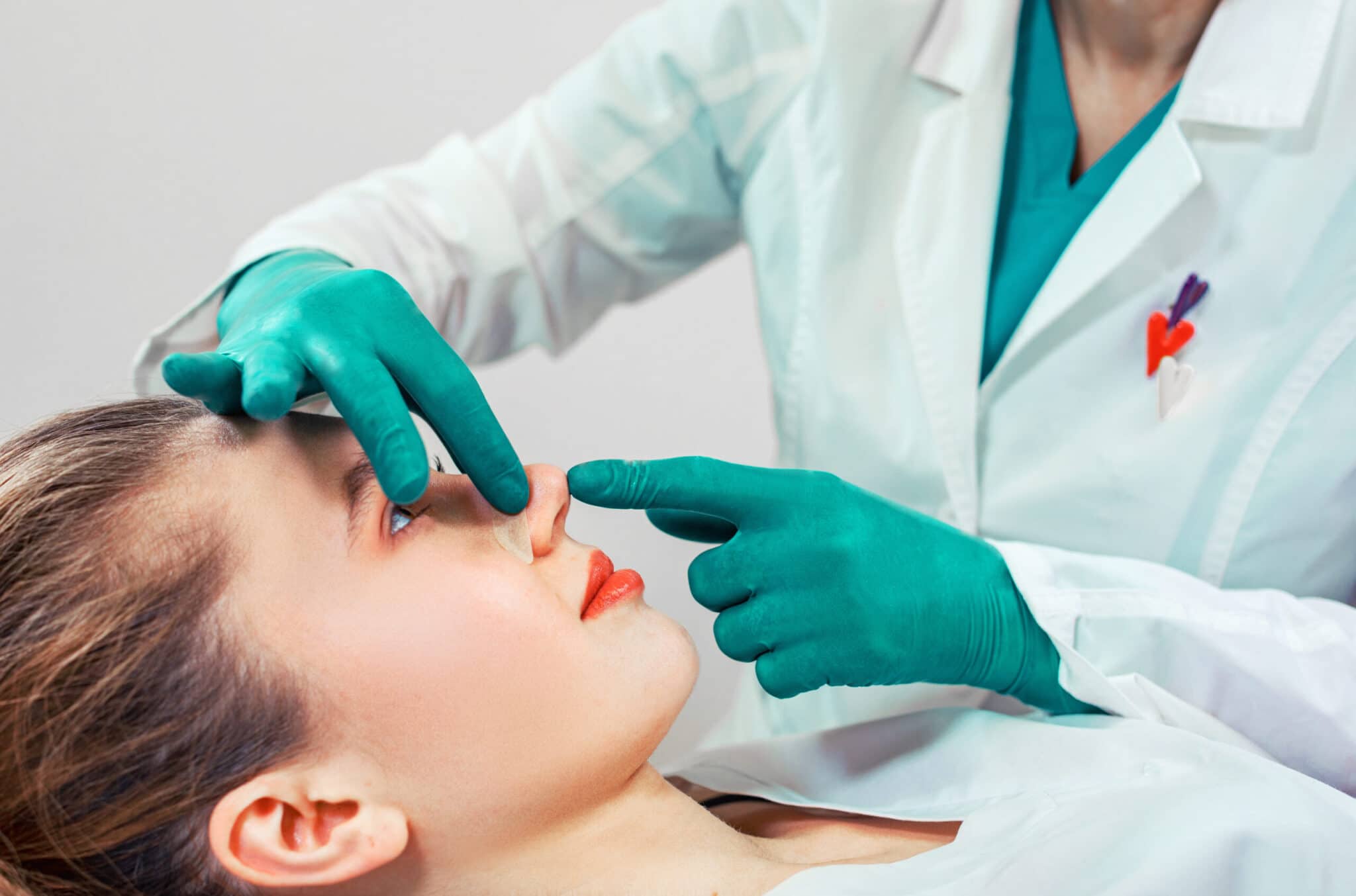 Rinoplastia