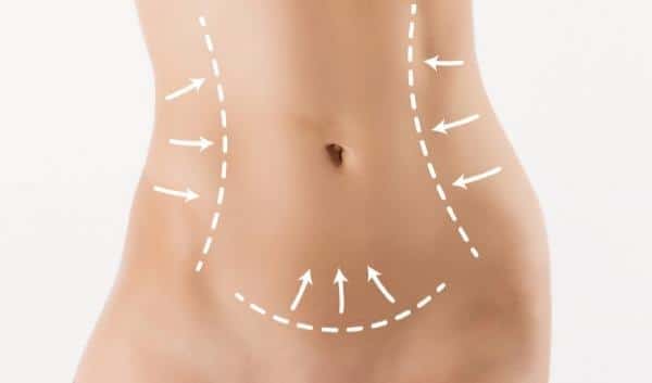 marcas para cirurgia plástica