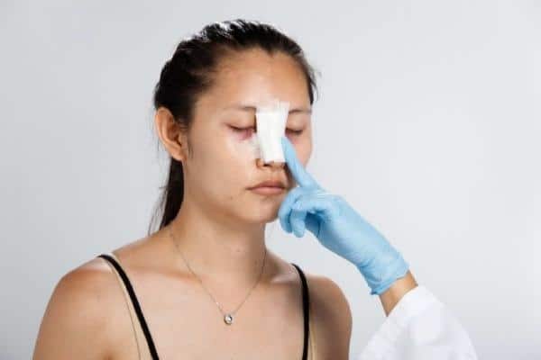 curativo de rinoplastia