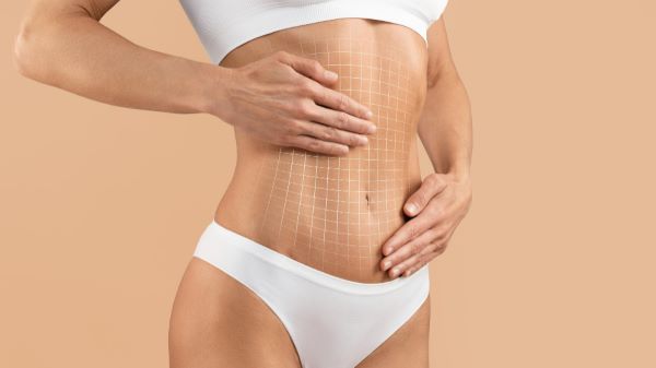 Barriga feminina com desenho de malha para abdominoplastia.