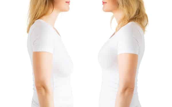 Mulher com flacidez mamária corrigida após mamoplastia.
