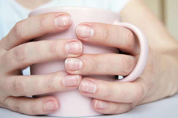 Mãos femininas segurando uma caneca.  As unhas apresentam ,claramente, sinais de fraqueza.